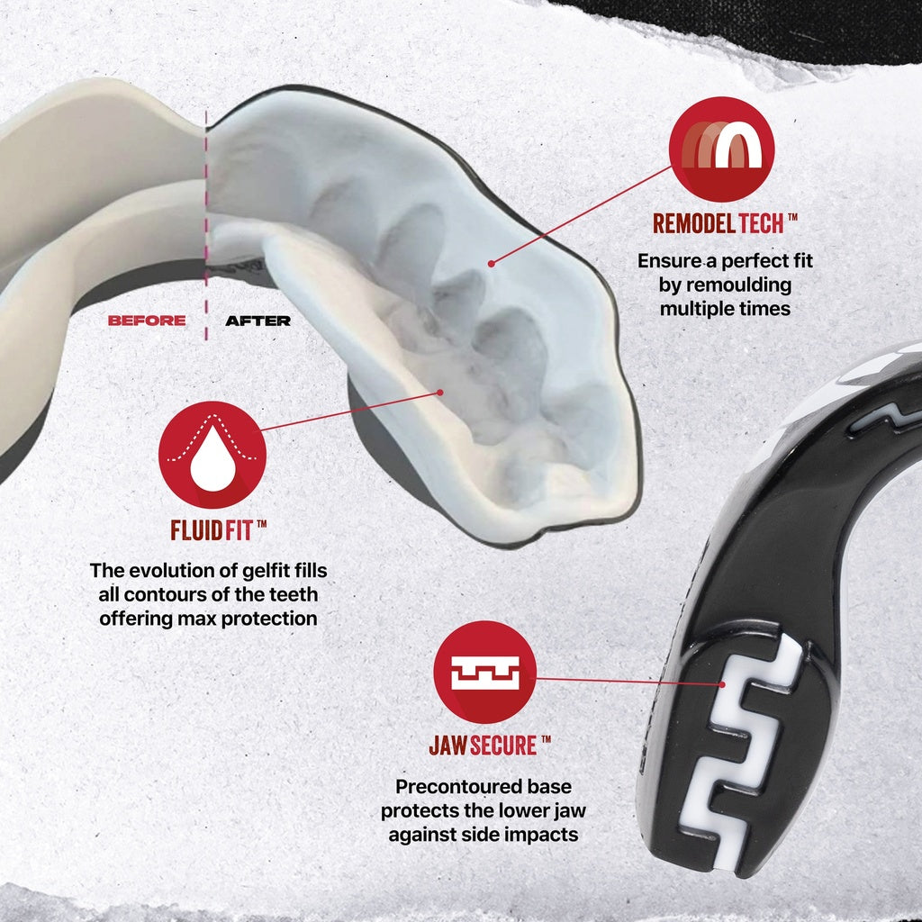 Safejawz Vampire Mouthguard