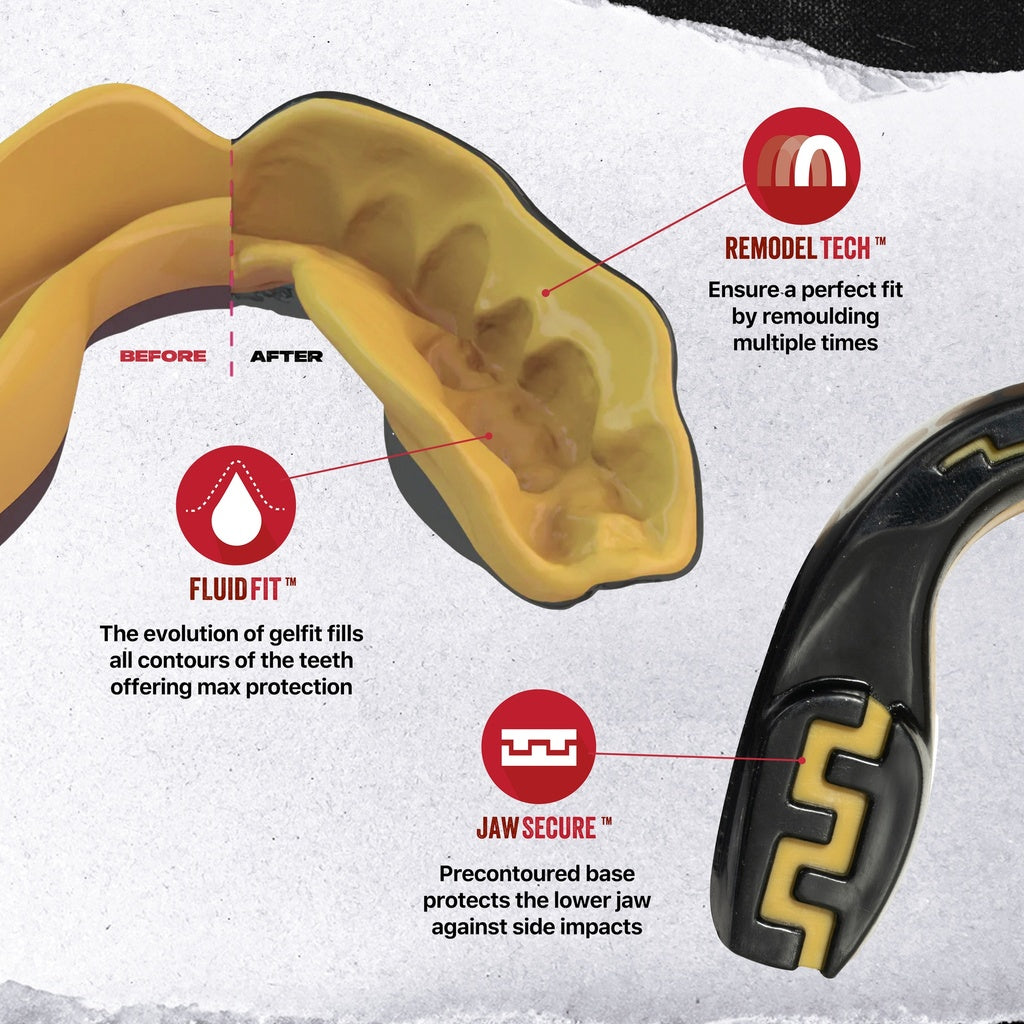 Safejawz Gold Teeth Mouthguard